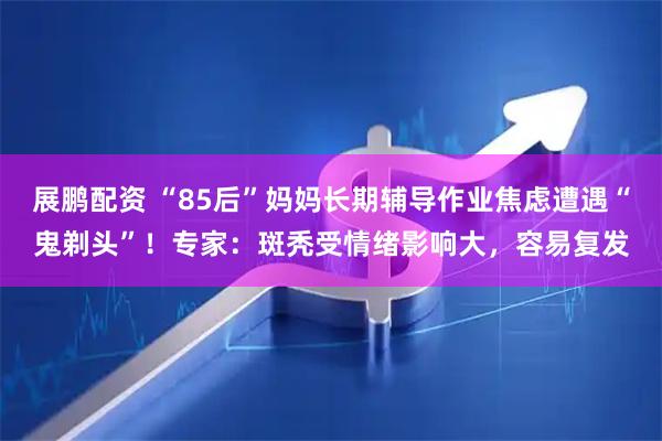 展鹏配资 “85后”妈妈长期辅导作业焦虑遭遇“鬼剃头”！专家：斑秃受情绪影响大，容易复发